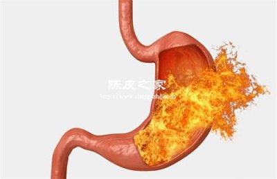 有胃火能喝陳皮山楂泡水嗎