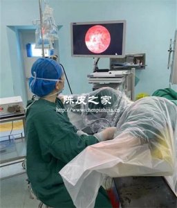 宮腔鏡檢查后能喝陳皮水嗎