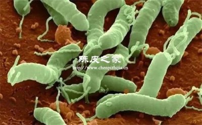 科學家發現陳皮竟能抑制這類病菌